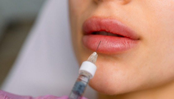 تزریق فیلر لب