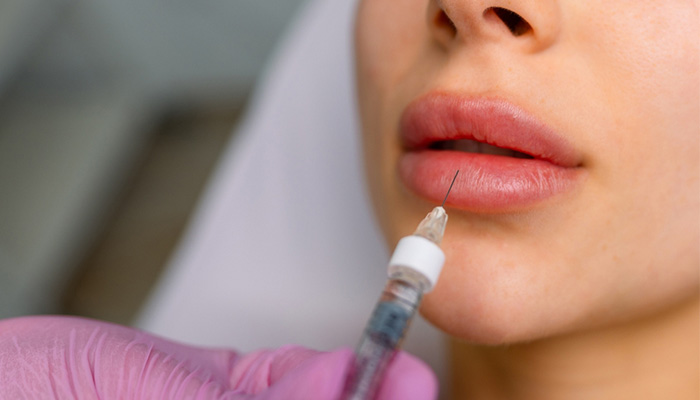 تزریق فیلر لب