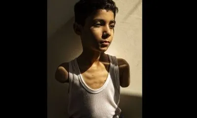 عکس کودک فلسطینی، برنده ورلدپرس ۲۰۲۵ شد