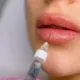 تزریق فیلر لب
